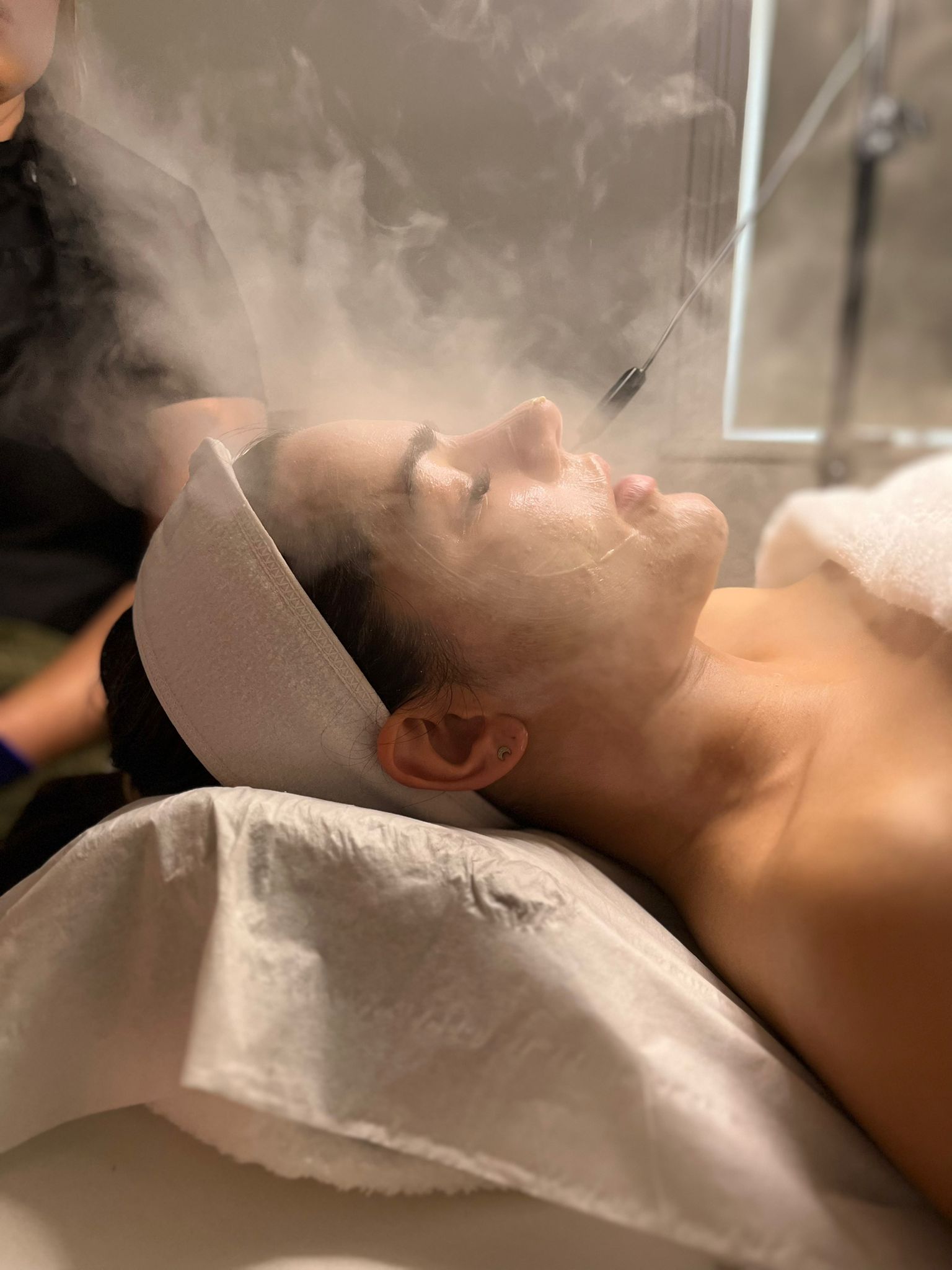 IMG_2235 Dermaplaning Haywards Heath