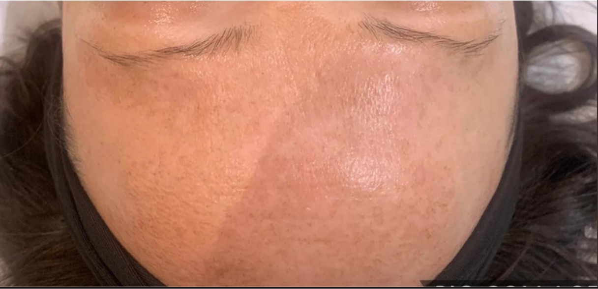 Pro Power Peel